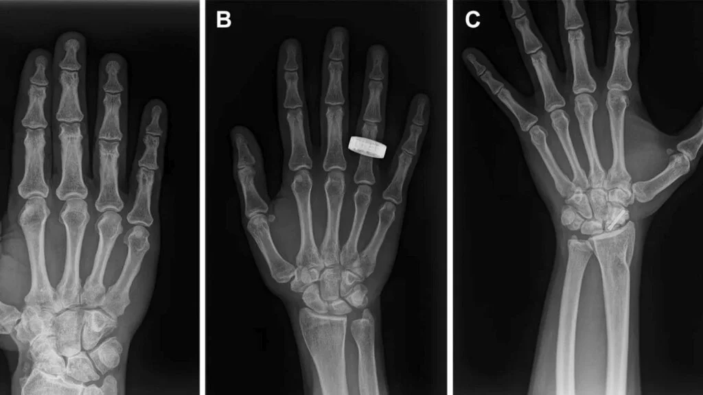 Astronautas logran radiografía en órbita, un paso clave para la salud espacial